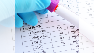 Cholesterol